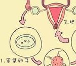 无精症做精子试管费用高吗？精子试管流程及成功率介绍